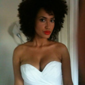 Andy Allo 
