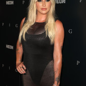 Kesha